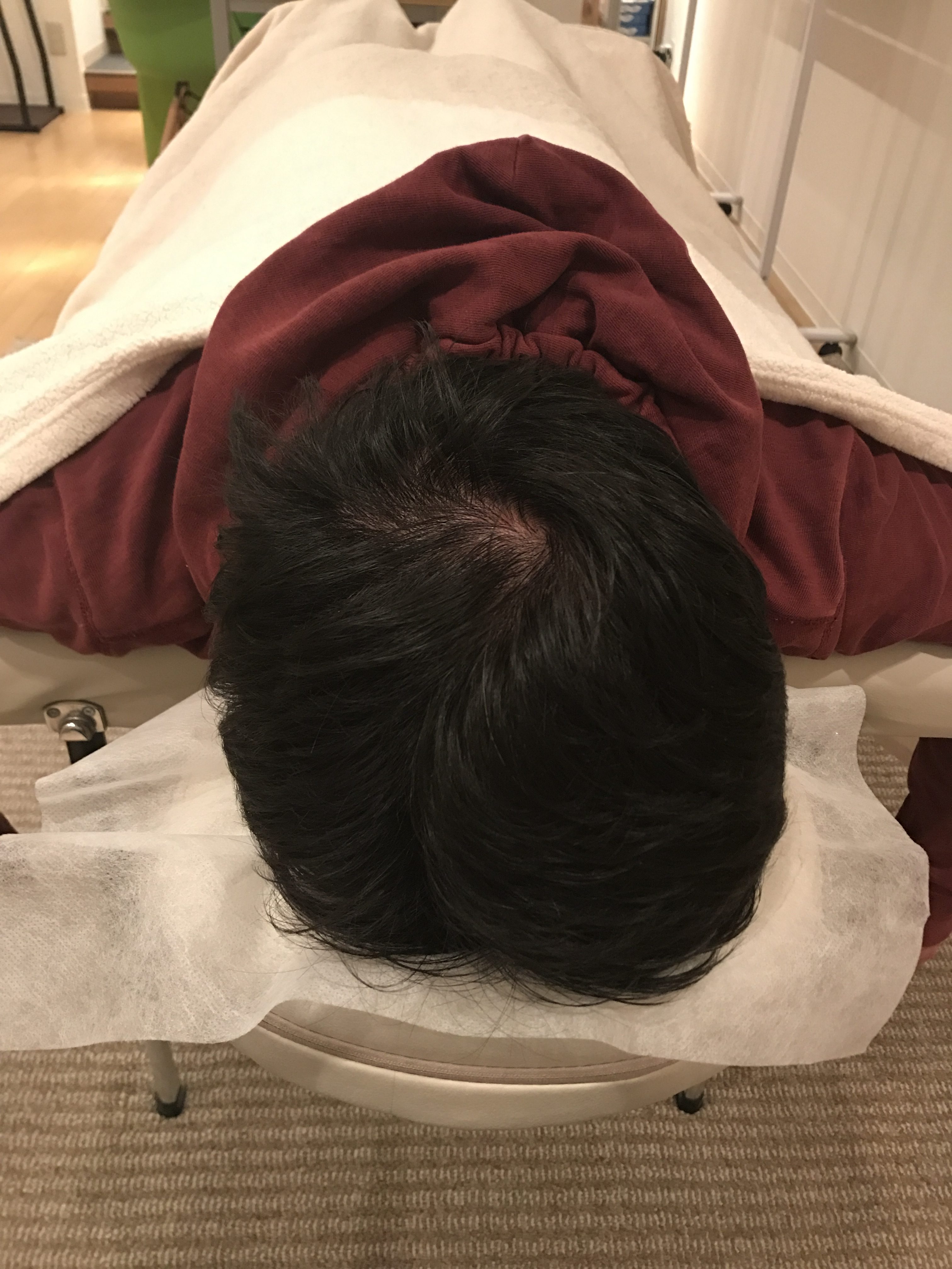 右側の頭痛とつまり感、眼精疲労、右半身の不調 江古田/東長崎「ながさき整骨院」