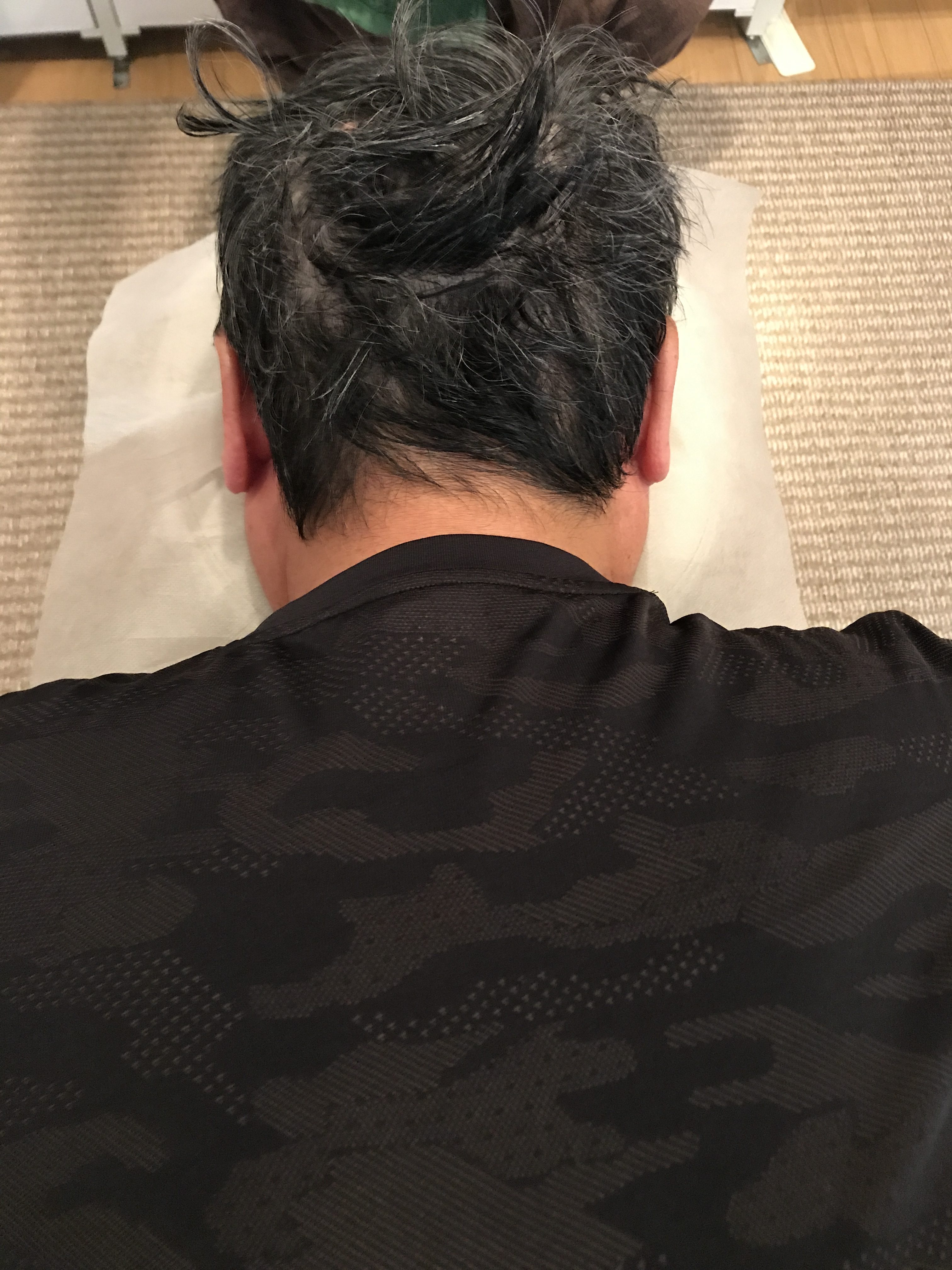 めまいと耳の位置の関係