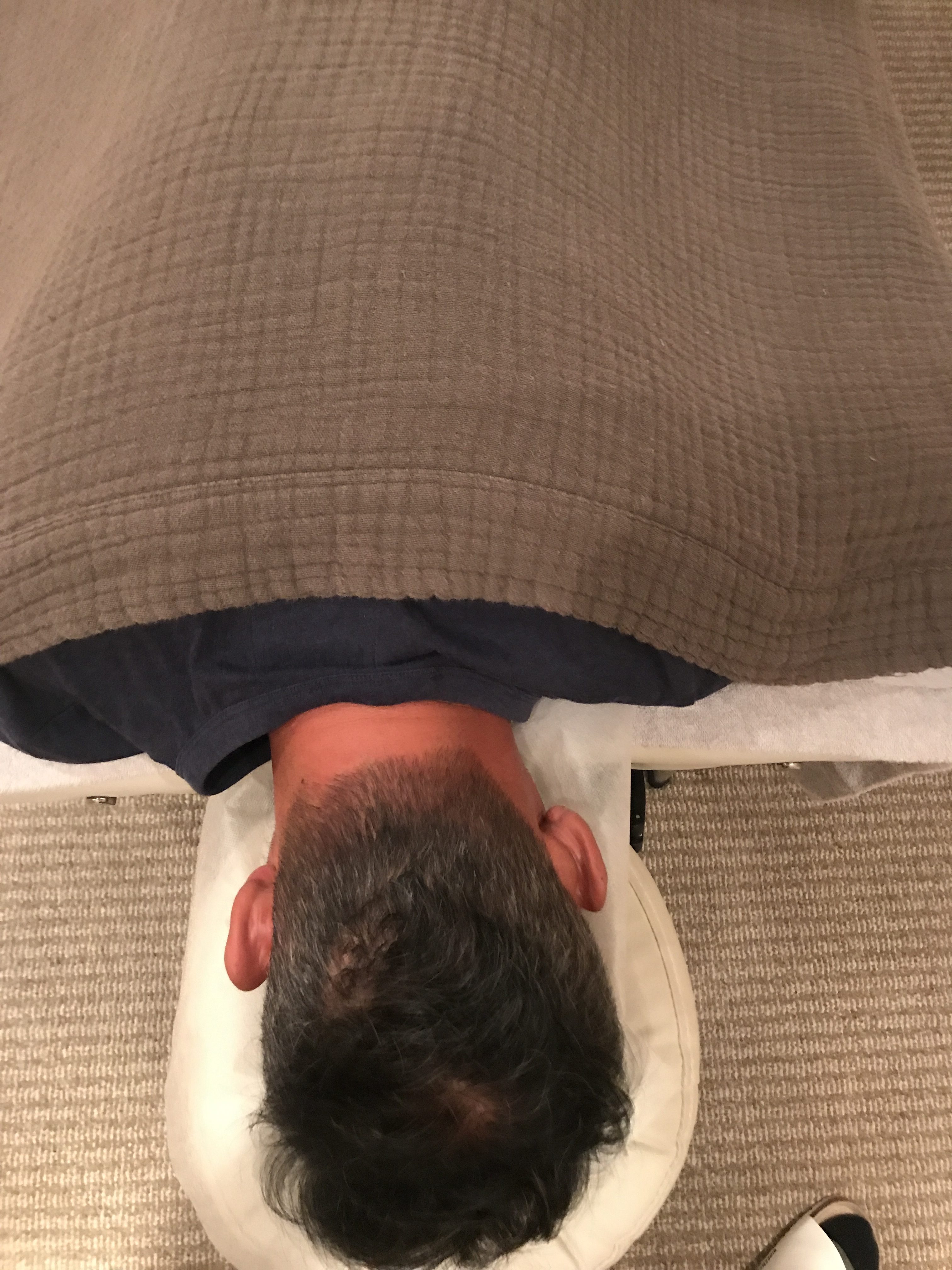 頭蓋骨がこれだけ歪んでいると、どうなるのか?