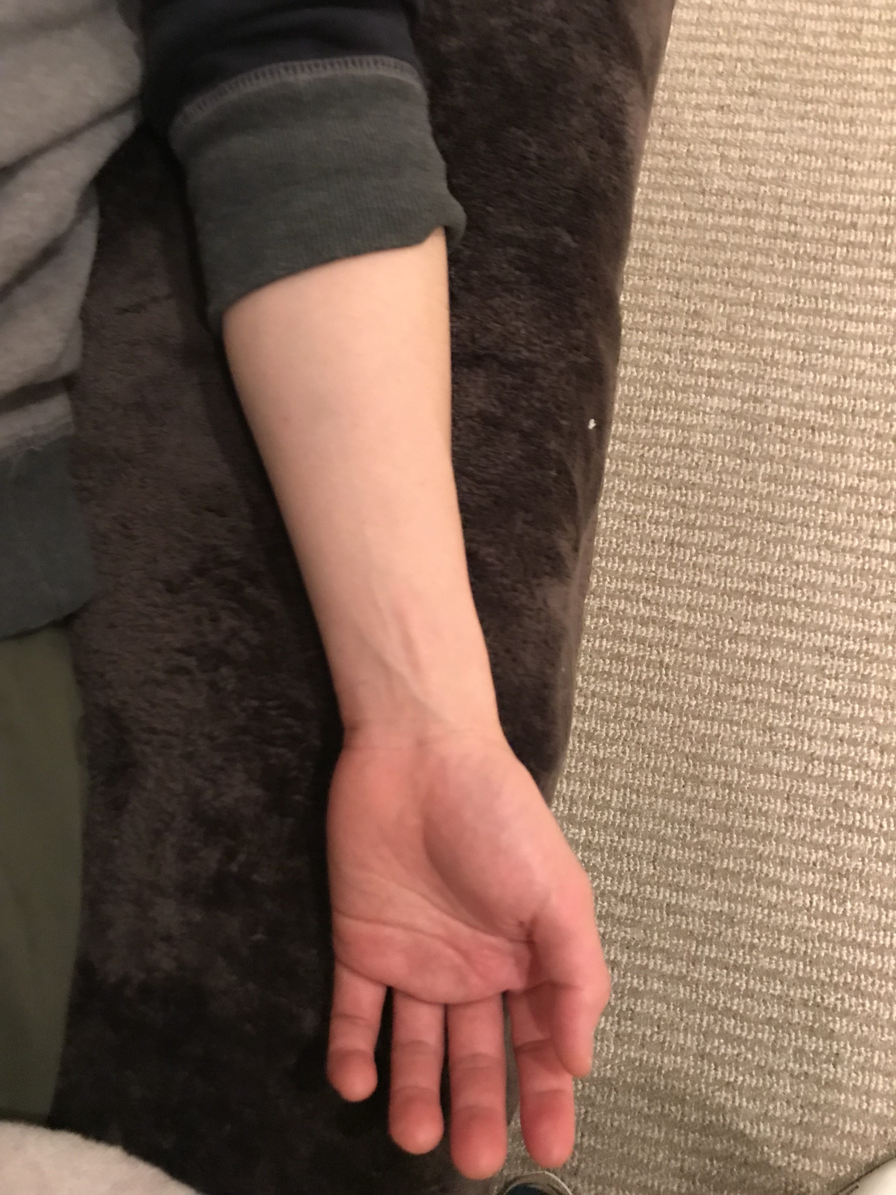 腕の疲れの原因とは?