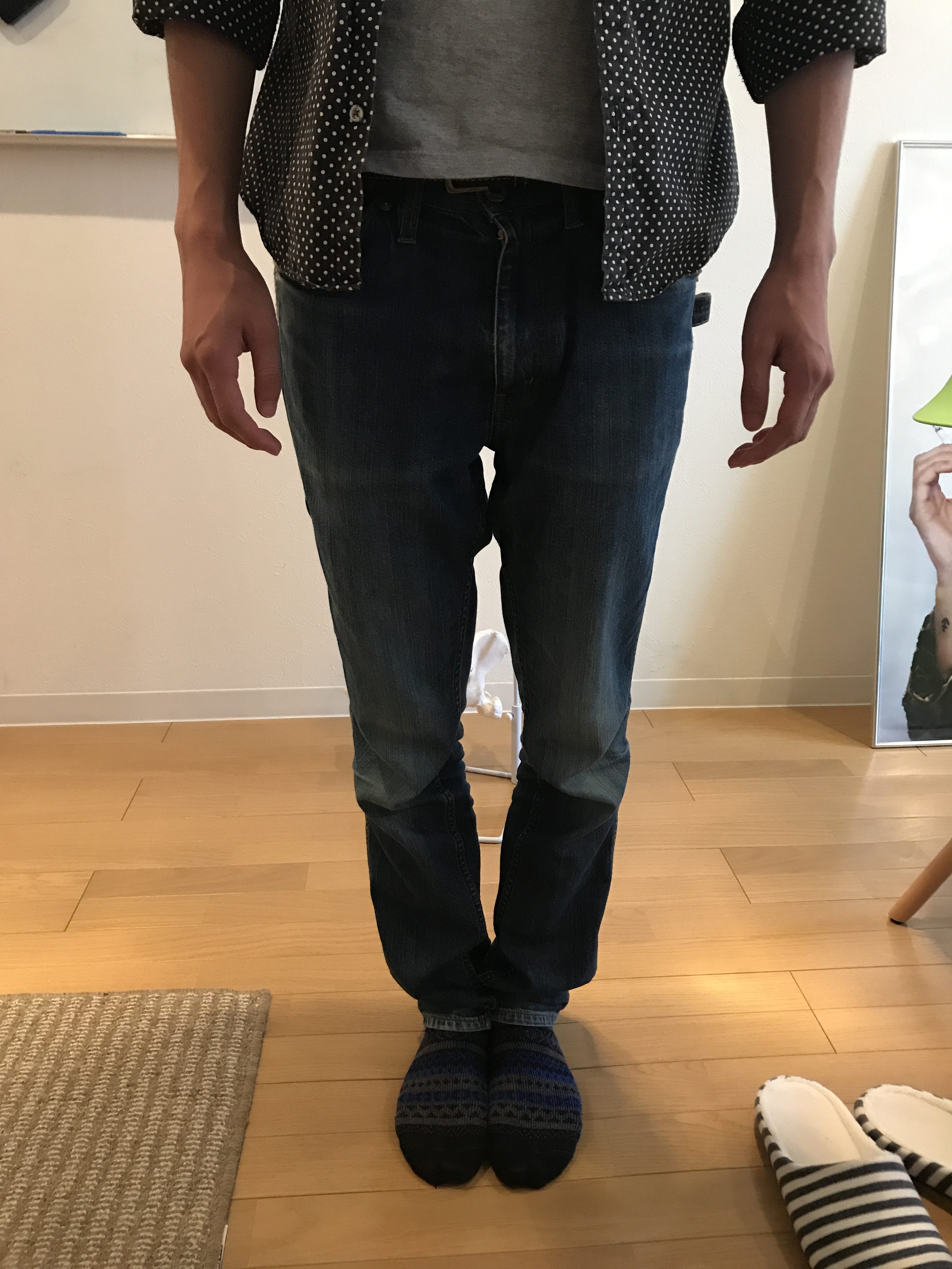 O脚を改善していかないと、身体が歪みやすい