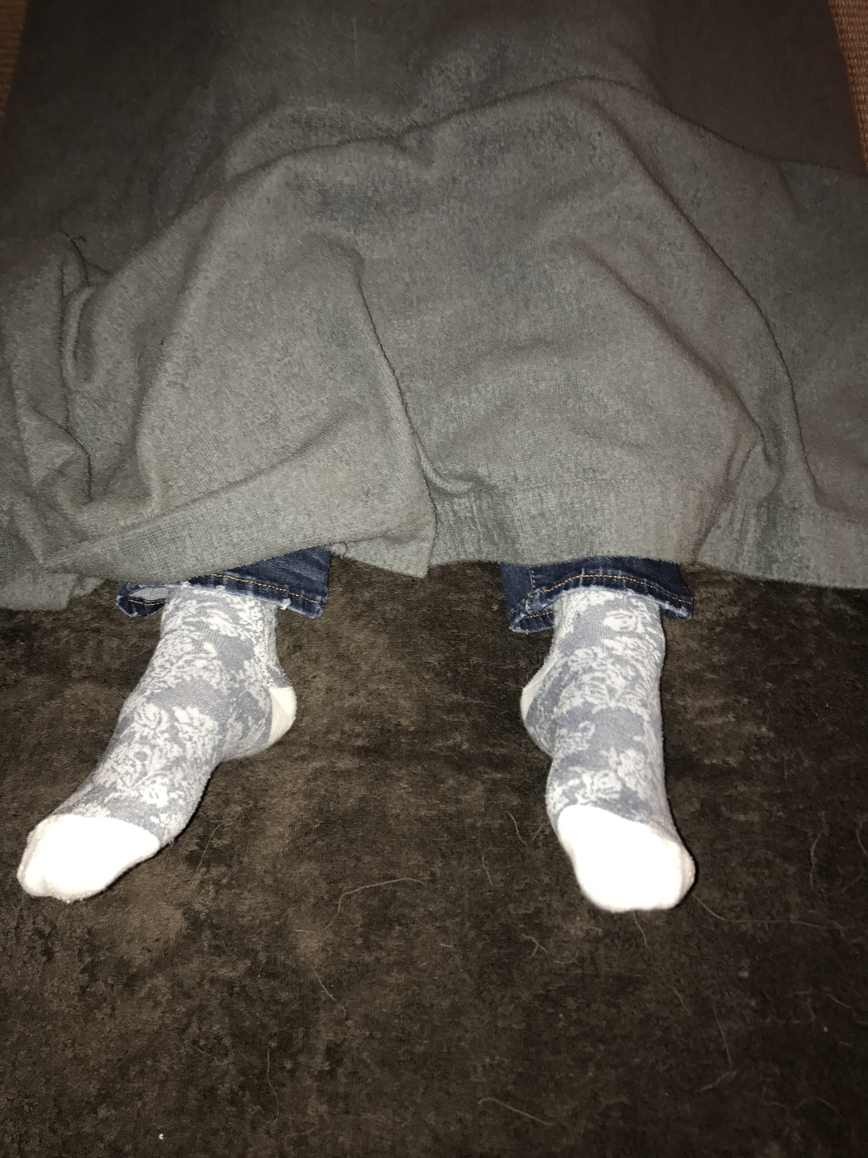 左足の親指の付け根が硬い方が多い